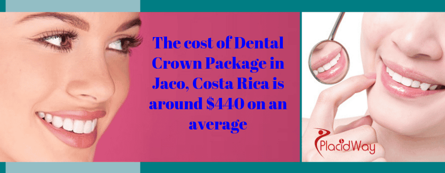 The cost of Dental Crown Package in Jaco, Costa Rica is around $440 on an average